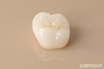 審美歯科について徹底解説致します | 世田谷区桜新町 「桜新町グリーン