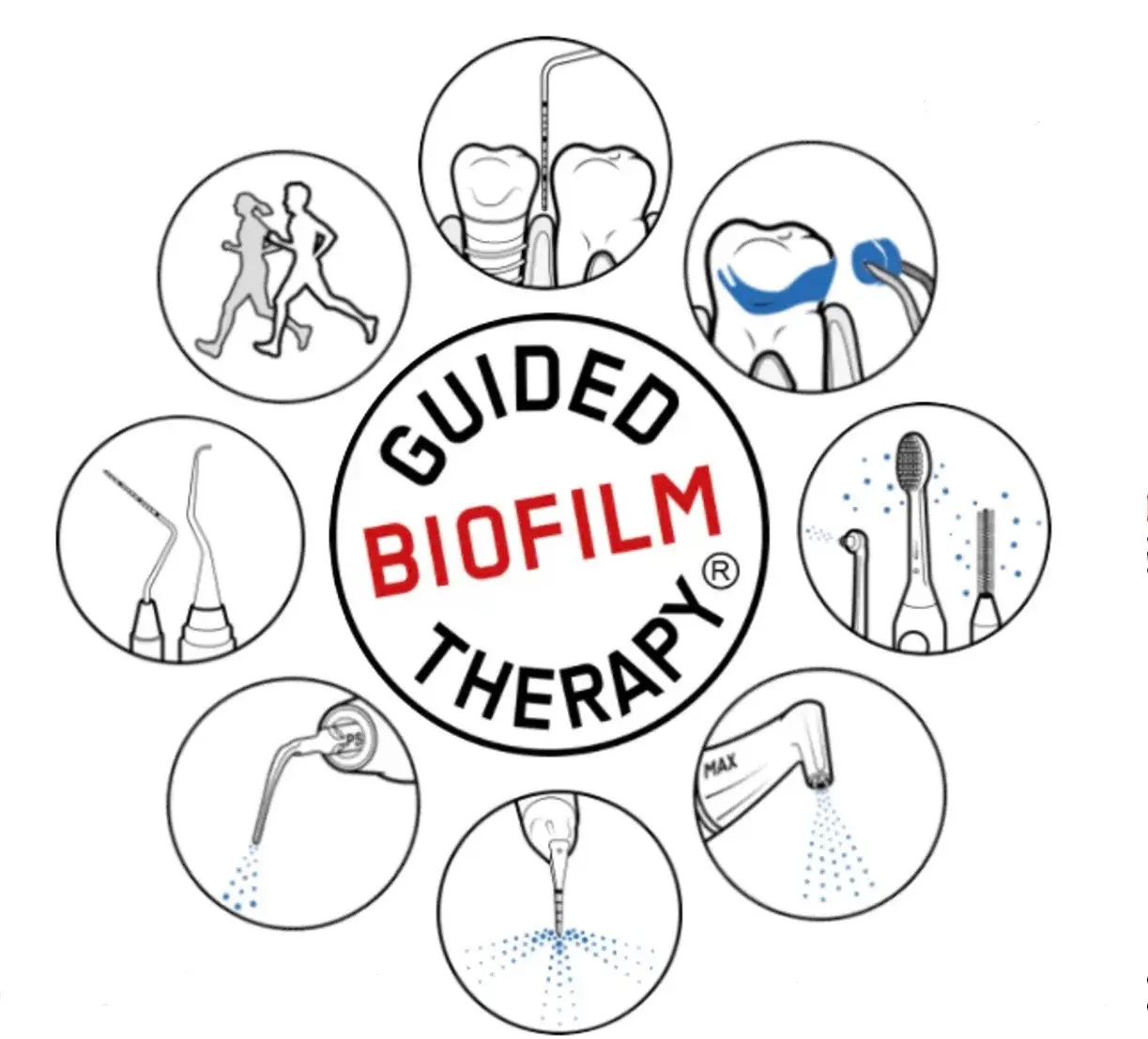 エアフロー　プラーク除去　歯周病予防